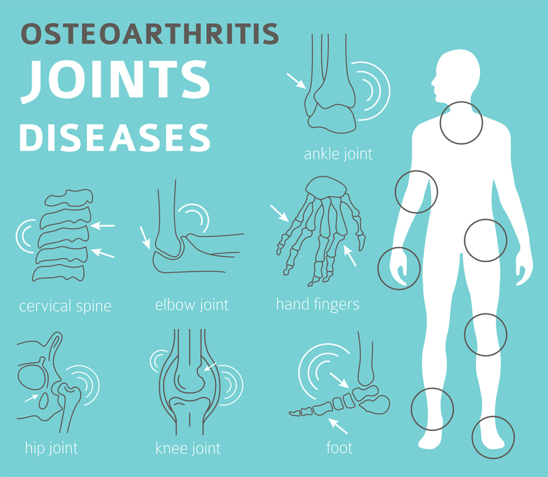 image shows different joints that can be affected by osteoarthritis